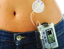 insulin pump